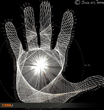 ذهن زيبا در يك دانشجوي ترك تحصيلي در اثر آسيب مغزي