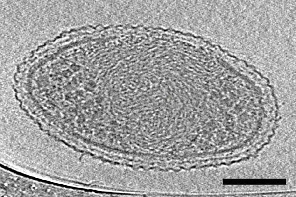 تصاویر میکروسکوپی دقیق از باکتریهای فوقکوچک تصاویر میکروسکوپی دقیق از باکتریهای فوقکوچک