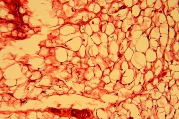 شناسایی کلاس جدیدی از چربی ها در بدن