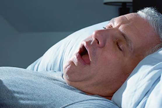 خروپف شدید علائمی از بروز دیابت و آلزایمر زودرس