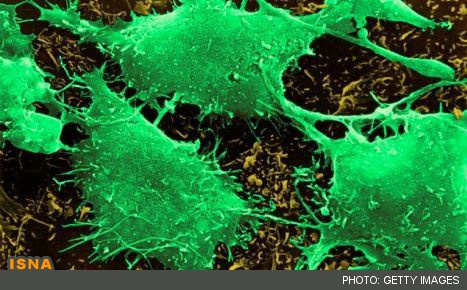 مدل‌سازی ریاضی رشد تومور سرطانی