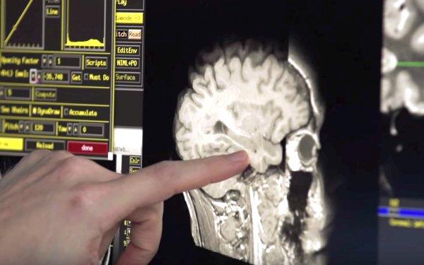 اولین بانک مغز در کشور راه اندازی شد اولین بانک مغز در کشور راه اندازی شد