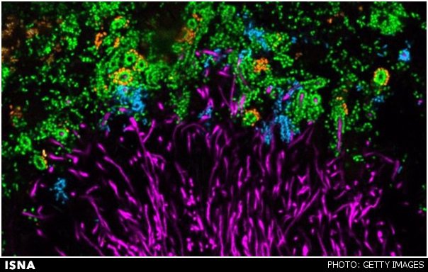 تصاویر رنگارنگ از میکروب‌های دندان