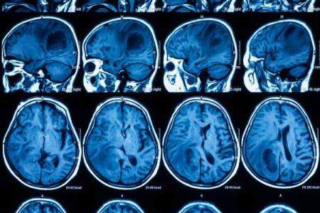 از بین بردن سرطان با سلول های پوست