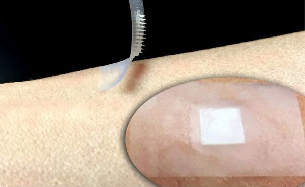 انقلابی در کنترل قند خون دیابتی‌ها با نخستین چسب انسولین هوشمند