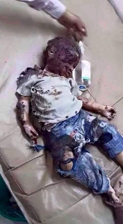 عربستان انتقام جمعه خونین را از کودکان می گیرد (عکس18+)