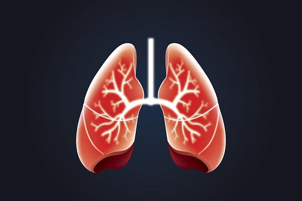 آیا مشکل تنفسی شما از آسم ناشی می‌شود؟