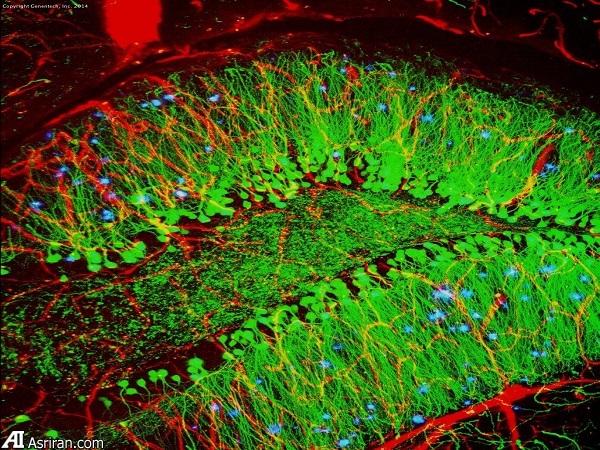 معکوس کردن نشانه‌های آلزایمر در آزمایشی جدید