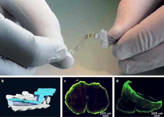 ساخت نسل جدید ایمپلنتها با ابتکارعمل خواهر گوگل