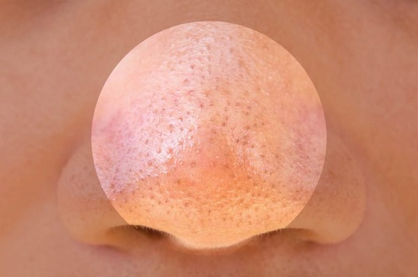 رابطه استرس و شرایط پوست