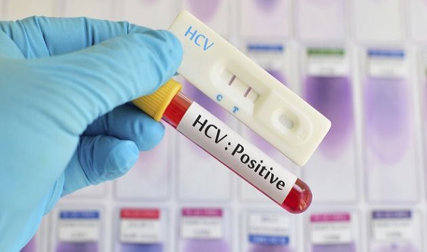 8 بیماری&zwnj; خطرناک که در خفا گسترش می&zwnj;یابند