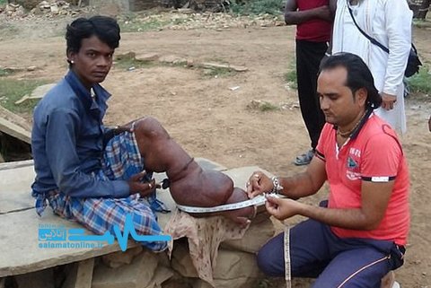 روش بسیار عجیب یک مادر برای درمان بیماری فرزندش (+عکس)