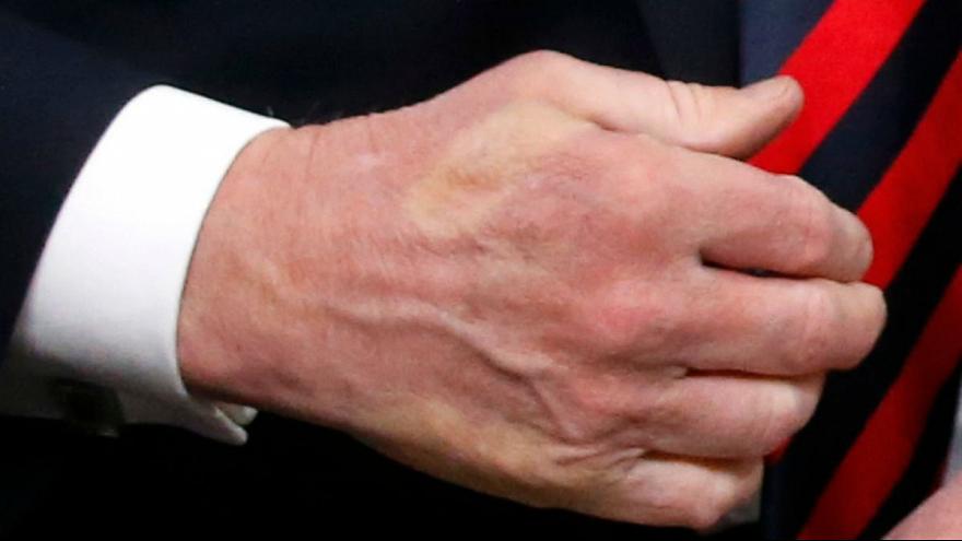 رد انگشت شست مکرون روی دست ترامپ ماند (عکس) / ماکرون: هدفدار بود