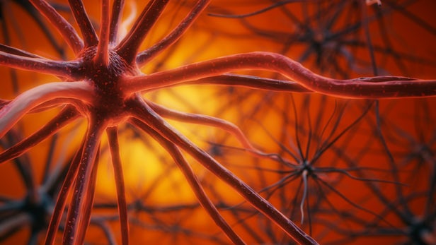 چرا پلاک&zwnj;های آلزایمر همواره به زوال عقل منجر نمی&zwnj;شوند؟