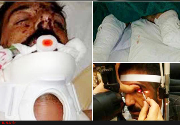 کولبر قربانی مین هیچ بیمه&zwnj;ای ندارد/ کلیه&zwnj;هایم را می فروشم تا هزینه عمل چشمم را جور کنم