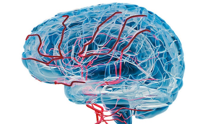 زوال عقل عروقی و دانستنی&zwnj;هایی درباره آن