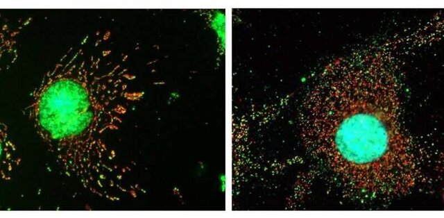 سلول&zwnj;ها چگونه از خود در برابر ویروس&zwnj;ها دفاع می&zwnj;کنند؟