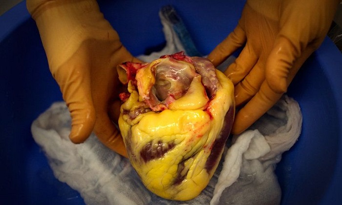 بهترین روش برای کاهش یک چربی خطرناک