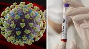 ارسال کیت تشخیص کرونا از ایران به ونزوئلا