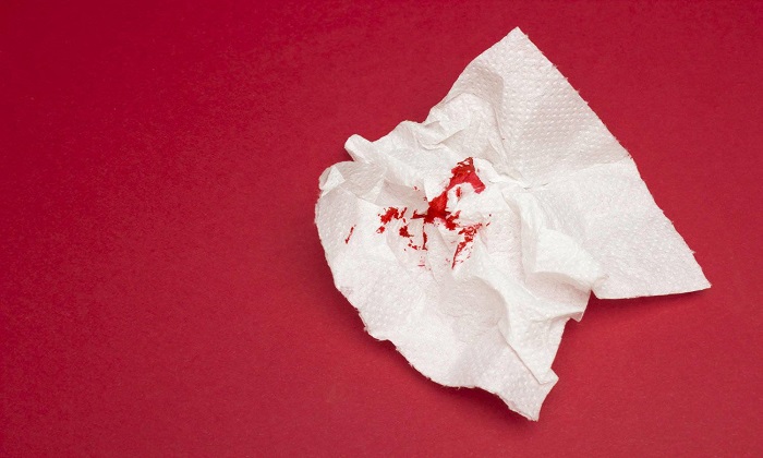 لخته&zwnj; خون و 7 دلیل وجود آن در مدفوع