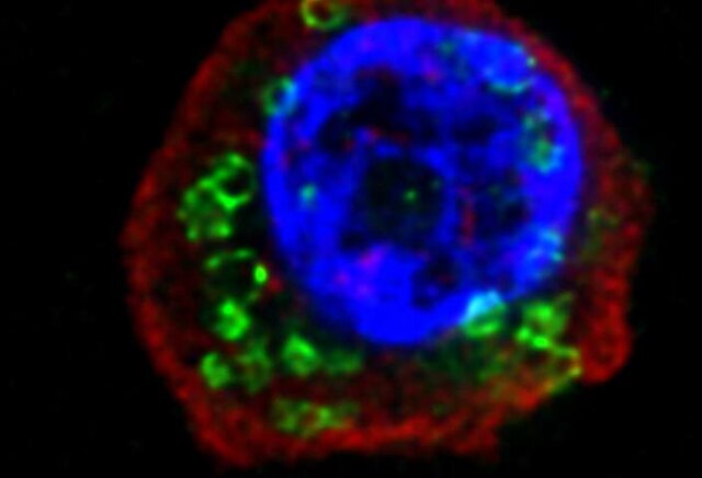 کرم&zwnj;های انگلی