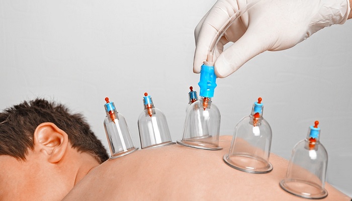 دانستنی&zwnj;هایی درباره حجامت