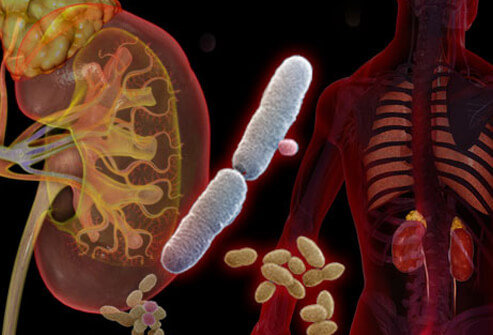 در بحران کرونا عفونت ادراری را جدی بگیرید