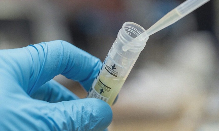 عفونت دستگاه ادراری در برابر عفونت کلیوی: از علائم تا پیشگیری عفونت دستگاه ادراری در برابر عفونت کلیوی: از علائم تا پیشگیری