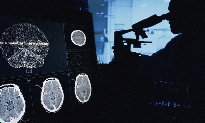 دانستنی&zwnj;هایی درباره تومورهای گلیوما