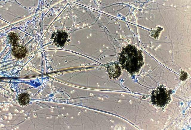 قارچ سیاه و دانستنی&zwnj;هایی درباره آن