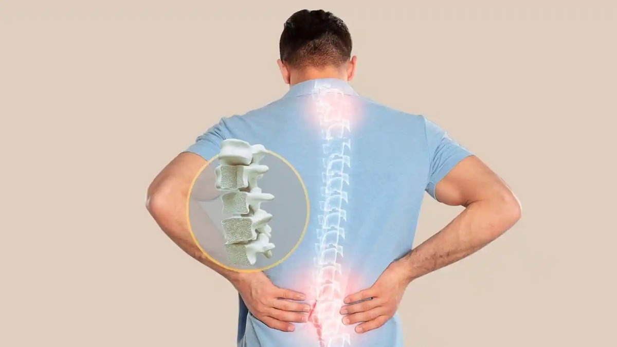 امتیاز FRAX؛ شاخصی برای محاسبه درصد احتمال شکستگی ناشی از پوکی استخوان(+عکس)