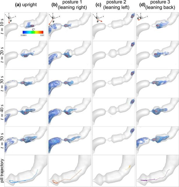 روشی که می تواند تاثیرگذاری قرص های مسکن را تسریع کند