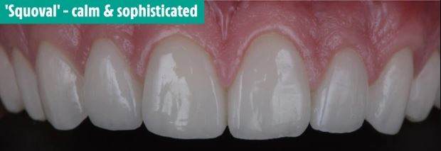 دندان های شما در مورد شخصیت تان چه می گویند؟