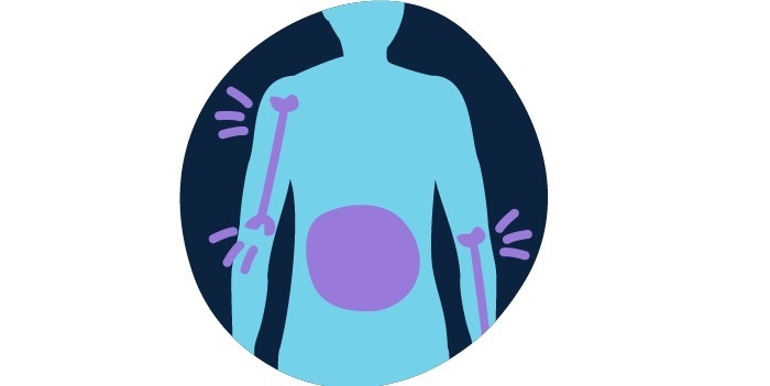 سرطان خون و همه چیز درباره نشانه های آن سرطان خون و همه چیز درباره نشانه های آن