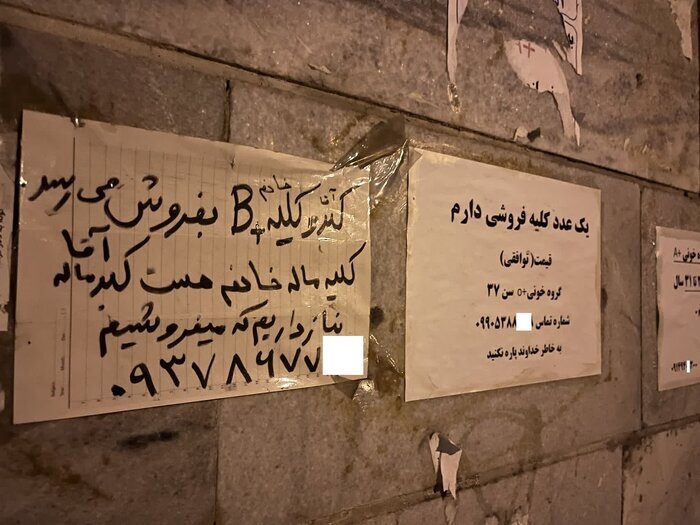  عضو بدن شما را خریداریم! / فروش دلاری کلیه با سفر ایرانی ها به ترکیه و عراق