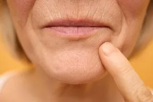 چرا لب‌ها با افزایش سن نازک‌تر به نظر می‌رسند؟