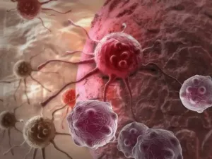 با این ورزش ساده خطر مشکلات پروستات را کم کن