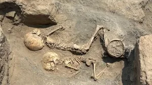 جراحی جمجمه در آسیای مرکزی ۴۰۰۰ سال قبل