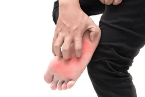 خارش کف پا از دید پزشکی؛ از خشکی پوست تا اختلالات داخلی بدن