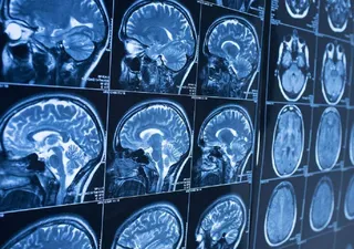 عکس واقعی و عجیب از یک بیگانه هنگام سی تی اسکن بیمار