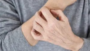 نشانه‌های پوستی که از بیماری خبر می‌دهند
