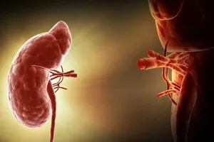 پیشرفت بزرگ در پیوند کلیه؛ عبور از مانع ناسازگاری گروه خونی